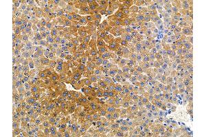 ABIN6265203 and ABIN6266635 at 1/100 staining Mouse liver tissue by IHC-P.