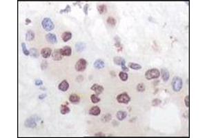 Immunohistochemistry (IHC) image for anti-Mitogen-Activated Protein Kinase-Activated Protein Kinase 5 (MAPKAPK5) (truncated) antibody (ABIN2464093) (MAPKAP Kinase 5 antibody  (truncated))