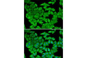 Immunofluorescence (IF) image for anti-Malate Dehydrogenase 2, NAD (Mitochondrial) (MDH2) antibody (ABIN1980313)