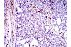 Immunohistochemistry (IHC) image for anti-Niemann-Pick Disease, Type C1 (NPC1) (AA 34-174) antibody (ABIN1724840)