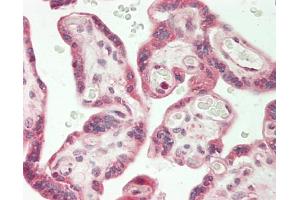 Human Placenta: Formalin-Fixed, Paraffin-Embedded (FFPE). (ADAM15 antibody  (HRP))