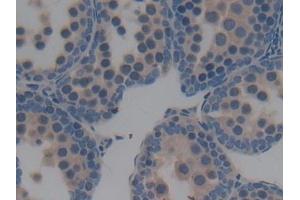 Immunohistochemistry (IHC) image for anti-Bactericidal/Permeability Increasing Protein (BPI) (AA 320-457) antibody (ABIN7433300)