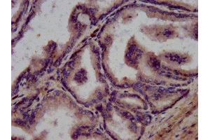 Immunohistochemistry (IHC) image for anti-WAP Four-Disulfide Core Domain 2 (WFDC2) (AA 31-124) antibody (ABIN7175671)