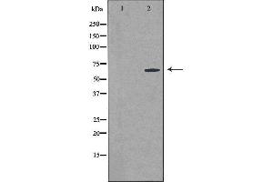 Western blot analysis of extracts from MCF-7 cells using CSTF2T antibody. (CSTF2T antibody  (N-Term))