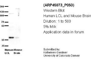 Image no. 2 for anti-Chromosome 21 Open Reading Frame 59 (C21orf59) (N-Term) antibody (ABIN2782393) (C21orf59 antibody  (N-Term))