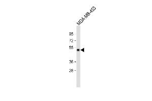 All lanes : Anti-GABRD Antibody (Center) at 1:2000 dilution Lane 1: MDA-MB-453 whole cell lysate Lysates/proteins at 20 μg per lane. (GABRD antibody  (AA 331-358))
