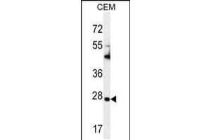 Western blot analysis in CEM cell line lysates (35ug/lane). (TIMP1 antibody  (C-Term))