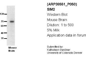 Image no. 1 for anti-Single-Minded Homolog 2 (SIM2) (N-Term) antibody (ABIN2780639) (SIM2 antibody  (N-Term))