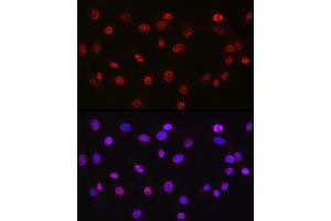 Immunofluorescence analysis of NIH/3T3 cells using DDX39A antibody (ABIN6131590, ABIN6139489, ABIN6139491 and ABIN6223963) at dilution of 1:50.