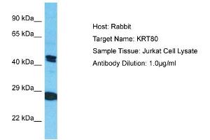 Host: Rabbit Target Name: KRT80 Sample Type: Jurkat Whole Cell lysates Antibody Dilution: 1. (KRT80 antibody  (C-Term))