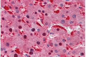 Human Liver: Formalin-Fixed, Paraffin-Embedded (FFPE) (IDH1 antibody  (AA 30-307))