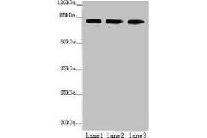 Western blot All lanes: AP4B1 antibody at 3 μg/mL Lane 1: HepG2 whole cell lysate Lane 2: U251 whole cell lysate Lane 3: LO2 whole cell lysate Secondary Goat polyclonal to rabbit IgG at 1/10000 dilution Predicted band size: 84, 35 kDa Observed band size: 84 kDa