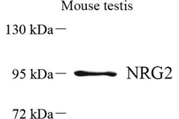 Neuregulin 2 antibody