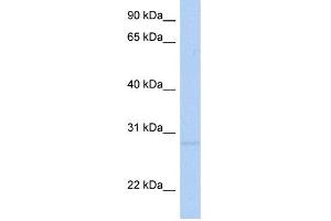 WB Suggested Anti-RNF41 Antibody Titration:  0. (RNF41 antibody  (Middle Region))