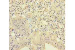 AGRP antibody  (AA 83-132)