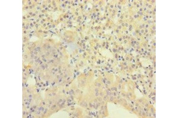 AGRP antibody  (AA 83-132)