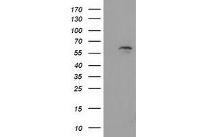 HEK293T cells were transfected with the pCMV6-ENTRY control (Left lane) or pCMV6-ENTRY EXD1 (Right lane) cDNA for 48 hrs and lysed. (EXD1 antibody)