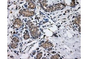 Image no. 3 for anti-Lipase, Endothelial (LIPG) antibody (ABIN1499163)