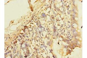 Immunohistochemistry of paraffin-embedded human small intestine tissue using ABIN7163662 at dilution of 1:100 (C10orf81 antibody  (AA 181-462))