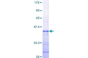 RNASEL Protein (AA 619-728) (GST tag)