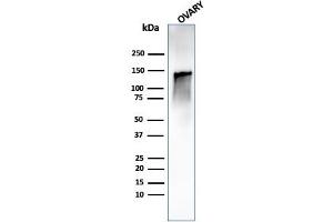 Western Blot Analysis of human ovary tissue lysate using Caldesmon Rabbit Recombinant Monoclonal Antibody (CALD1/1424R). (Recombinant Caldesmon antibody)