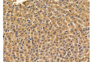 ABIN6264816 and ABIN6279786 at 1/100 staining rat liver tissue by IHC-P.