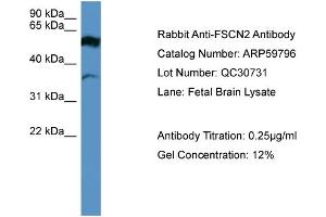 WB Suggested Anti-FSCN2  Antibody Titration: 0. (Fascin 2 antibody  (Middle Region))