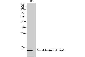 Western Blot analysis of KB cells using Acetyl-Histone H4 (K12) Polyclonal Antibody diluted at 1:500. (Histone H4 antibody  (acLys12))