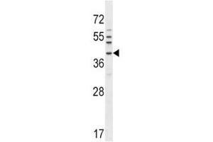 NKX6. (NKX6-1 antibody  (AA 285-314))