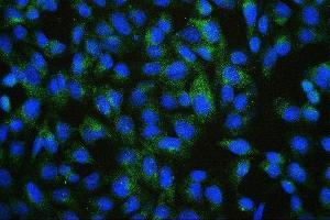 IF analysis of PDCD6IP using anti-PDCD6IP antibody (ABIN7600490).