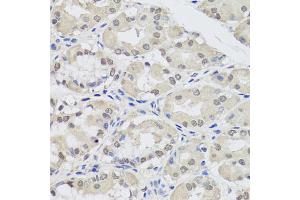 Immunohistochemistry of paraffin-embedded human stomach using AGO2 antibody (ABIN5974124) at dilution of 1/100 (40x lens). (AGO2 antibody)