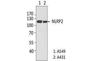 Western Blotting (WB) image for anti-NLR Family, Pyrin Domain Containing 2 (NLRP2) antibody (ABIN2666255) (NLRP2 antibody)
