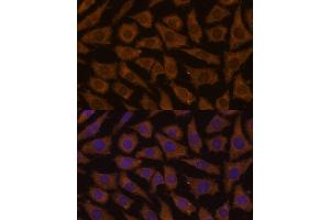 Immunofluorescence analysis of L929 cells using MTMR4 Polyclonal Antibody (ABIN7268764) at dilution of 1:100 (40x lens). (MTMR4 antibody  (AA 920-1195))