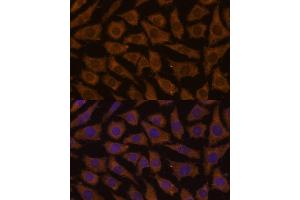 Immunofluorescence analysis of L929 cells using MTMR4 Polyclonal Antibody (ABIN7268764) at dilution of 1:100 (40x lens).