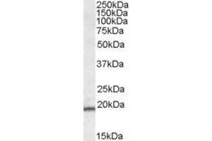 Western Blotting (WB) image for anti-PYD and CARD Domain Containing (PYCARD) (C-Term) antibody (ABIN184674)