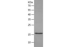 Western Blotting (WB) image for Mdm2, p53 E3 Ubiquitin Protein Ligase Homolog (Mouse) (MDM2) (AA 1-118) protein (His tag) (ABIN7123867) (MDM2 Protein (AA 1-118) (His tag))