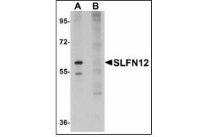 Western blot analysis of SLFN12 in SK-N-SH cell lysate with SLFN12 antibody at 1 µg/ml in (A) the absence and (B) the presence of blocking peptide.