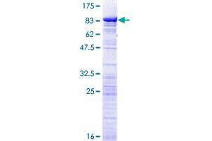 DDX56 Protein (AA 1-547) (GST tag)