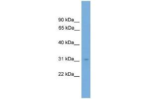 Human COLO205; WB Suggested Anti-NRBF2 Antibody Titration: 0.