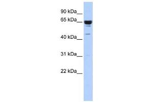 Western Blotting (WB) image for anti-Zinc Finger Protein 587 (ZNF587) antibody (ABIN2458435) (ZNF587 antibody)