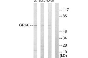 Western Blotting (WB) image for anti-G Protein-Coupled Receptor Kinase 6 (GRK6) (N-Term) antibody (ABIN1849364) (GRK6 antibody  (N-Term))
