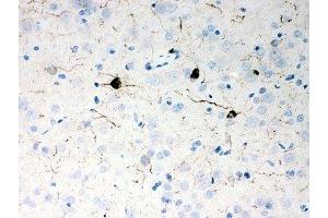 IHC-P: NPY antibody testing of rat brain tissue (NPY antibody  (Middle Region))