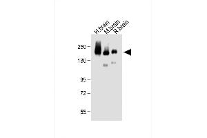All lanes : Anti-NC Antibody (C-term) at 1:500 dilution Lane 1: Human brain lysate Lane 2: Mouse brain lysate Lane 3: Rat brain lysate Lysates/proteins at 20 μg per lane. (CD56 antibody  (C-Term))