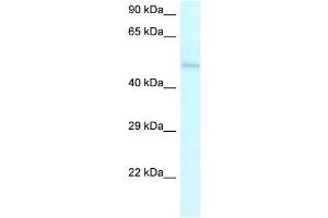 Human Jurkat; WB Suggested Anti-AMBN Antibody. (AMBN antibody  (C-Term))