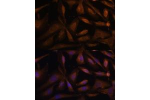 Immunofluorescence analysis of U-2 OS cells using UFC1 Polyclonal Antibody (ABIN6130770, ABIN6149886, ABIN6149887 and ABIN6217098) at dilution of 1:100 (40x lens). (UFC1 antibody  (AA 1-167))
