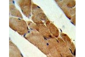 IHC analysis of FFPE human skeletal muscle stained with RANKL antibody (RANKL antibody  (AA 1-30))