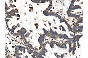 IHC analysis of PICALM using anti-PICALM antibody (ABIN7599516). (PICALM antibody  (AA 1-652))