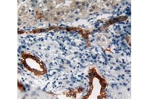 Immunohistochemistry (IHC) image for anti-Keratin 5 (KRT5) (AA 166-474) antibody (ABIN1172966)