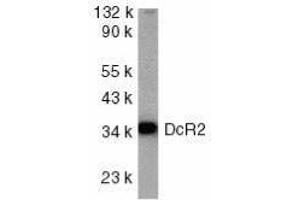 Western Blotting (WB) image for anti-Tumor Necrosis Factor Receptor Superfamily, Member 10d, Decoy with Truncated Death Domain (TNFRSF10D) (AA 249-263) antibody (ABIN2479560)