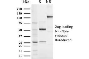 SDS-PAGE Analysis Purified Elastin Recombinant Rabbit Monoclonal Antibody (ELN/3131R).